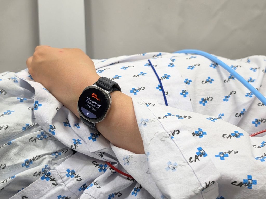 Samsung Galaxy Watch Predicts Vasovagal Syncope